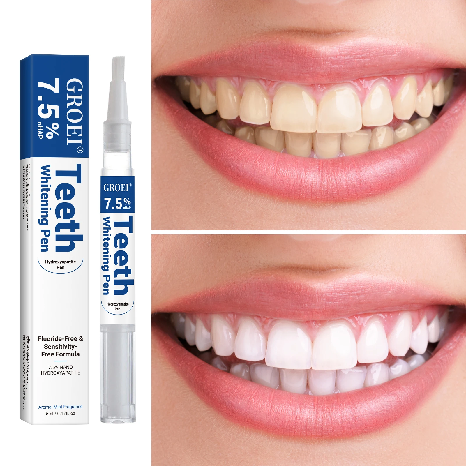Pena Pemutih Gigi Hidroksiapat - Teeth Whitening Before And After ulasan dan harga