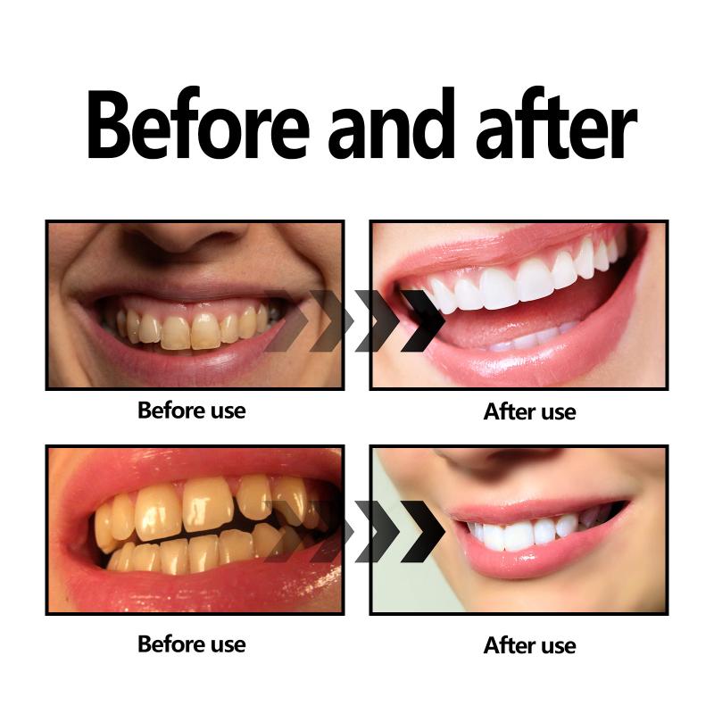 Bubuk Pemutih Gigi Arang / Bub - Teeth Whitening Baking Soda ulasan dan harga