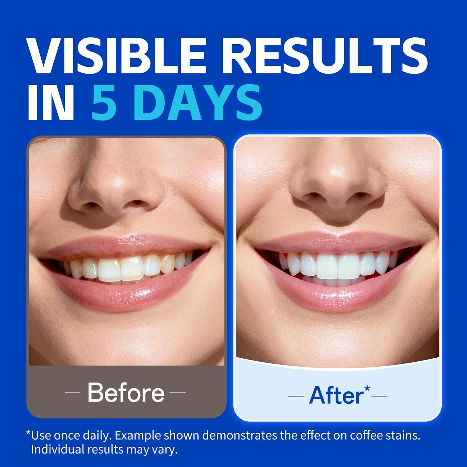7 pasang Strip Pemutih Gigi un - Teeth Whitening Street ulasan dan harga