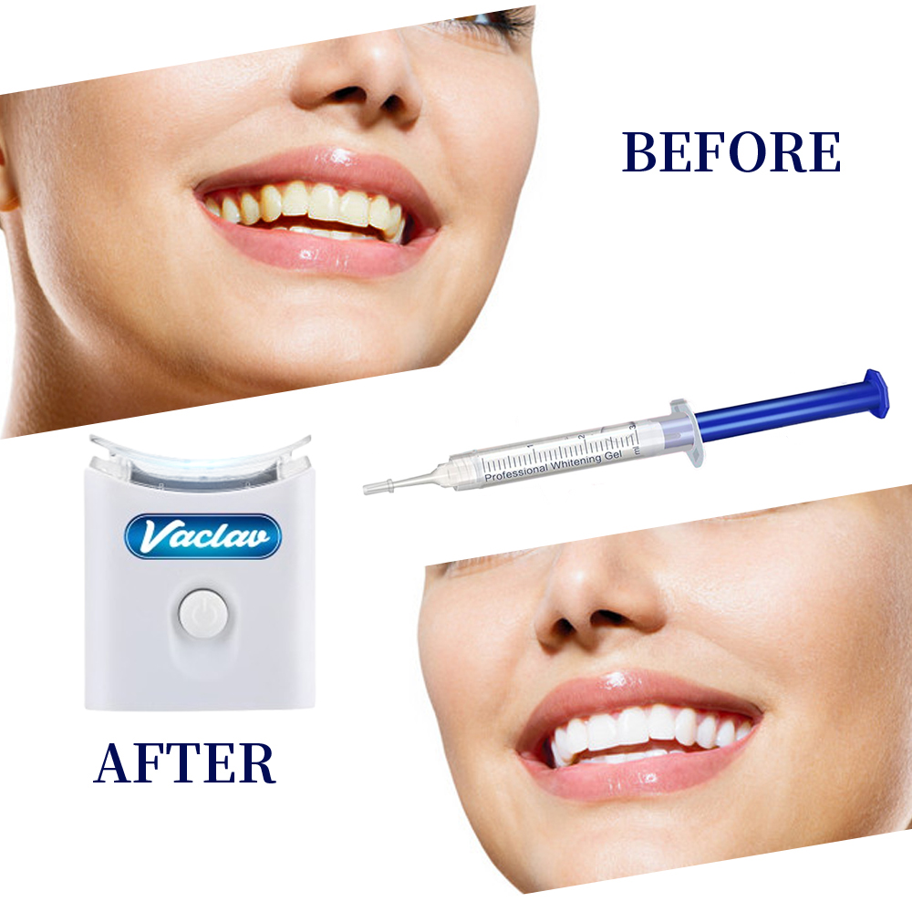 Kit Pemutih Gigi di Rumah deng - Teeth Whitening Baking Soda ulasan dan harga