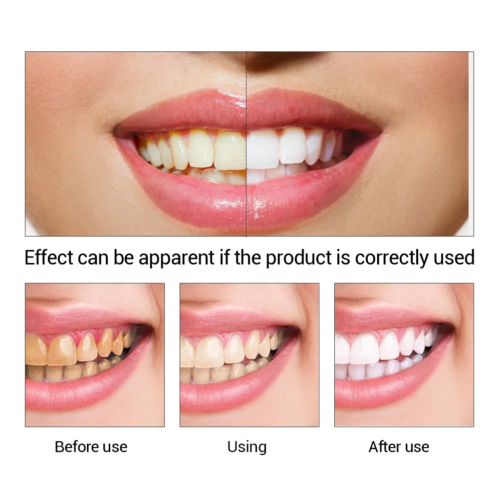 FTEENPLY Bubuk Esensi Pemutih  - Teeth Whitening Bleach ulasan dan harga