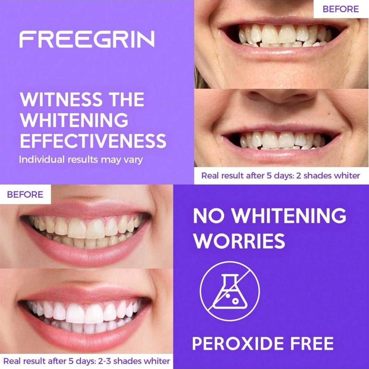Stiker Gigi Pemutih Mewah 7/14 - Teeth Whitening Before And After ulasan dan harga
