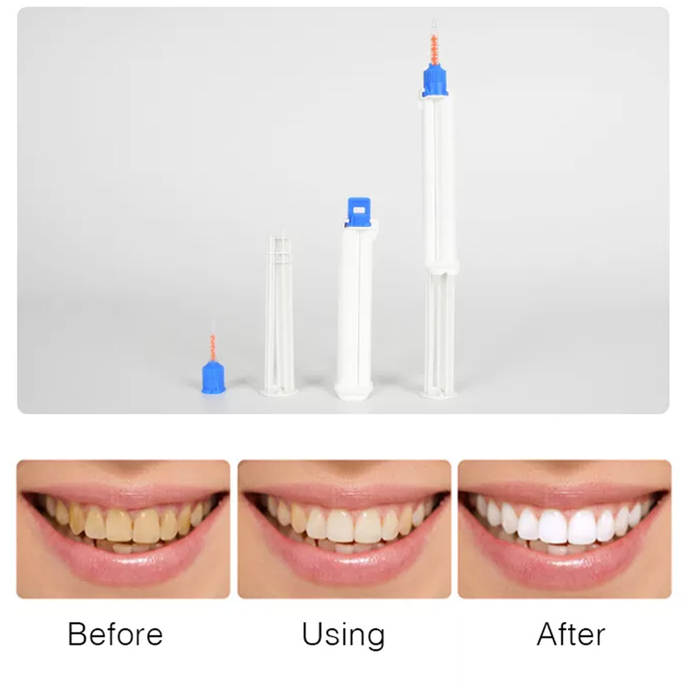 10/5/2 Buah Jarum Suntik Gigi  - Teeth Whitening Gingival Barrier ulasan dan harga